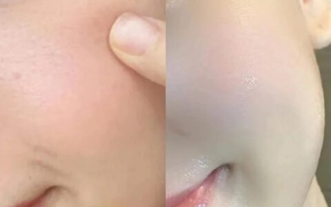 提拉紧致抗皱的护肤品哪个好？-提拉紧致抗皱的护肤品哪个好30岁