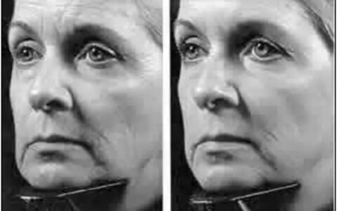 有哪些紧致效果的护肤品？-紧致皮肤的护肤品真的有用吗