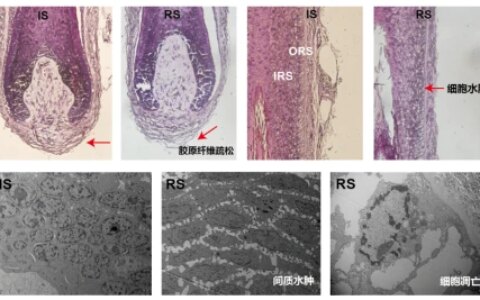 最前线｜头秃者的新福音，细胞冻存技术提升毛囊存活率-细胞冻存有哪些关键操作环节和技术