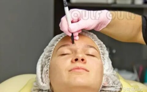 面部筋膜提升术的危害、中面部提升术的后遗症大吗，细品-筋膜提拉术手术全过程