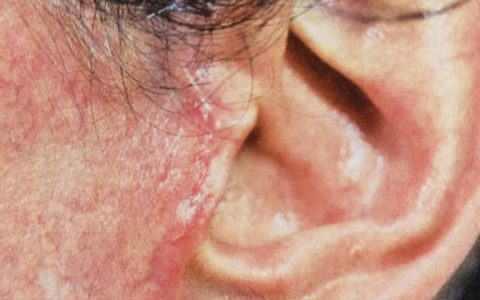 看了很多失败案例后不敢做面部提升，观望了一年才敢下定决心-如果做美容脸失败了怎么办?