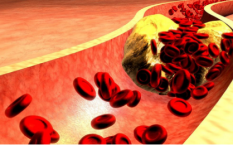 甘油三酯高吃什么才能降脂？胞倍力清血片药食同源可有效调理-甘油三酯什么药好