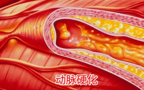 甘油三脂高对人体有什么危害？降低甘油三酯，这4招就够了-甘油三脂高怎么降下来