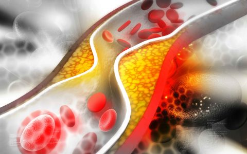 体检查出甘油三酯偏高怎么办？医生：做好这4点，或能有效降脂！-体检结果甘油三酯高是什么意思