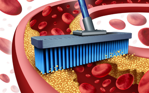 甘油三酯高，少吃三物，坚持三不，做好三勤，血脂降，减少并发症-甘油三酯高适合吃什么食物