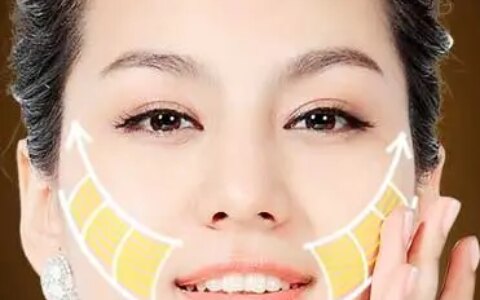 神普及：2021年7d聚拉提做全脸多少钱？7d聚拉提多久做一次？-7d聚拉提全脸多少发