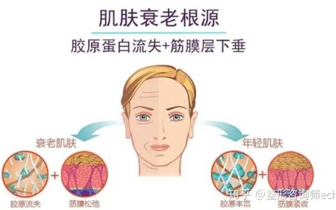 面部提升价格大概是多少？-面部提升怎么样