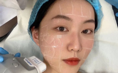 7d聚拉提全脸多少钱做一次，效果维持多久-7d聚拉提全脸是什么意思