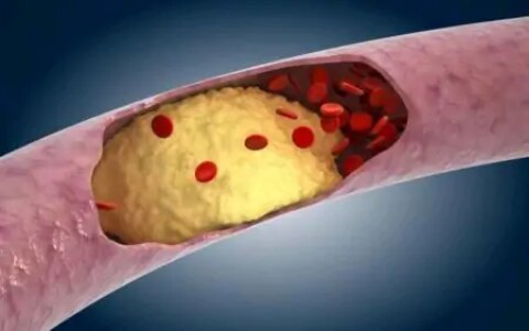 每天喝白酒，对血脂有什么影响？想要血脂稳定，可多喝5种茶水-白酒影响血脂吗