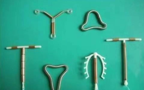 避孕上环有啥“副作用”？节育环逾期不取的危害，医生都为之心疼-避孕环时间到了不取可以吗