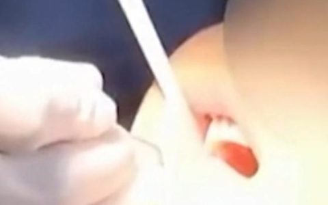 “功能性牙膏”热卖，10岁女孩为补牙却损失6颗牙（功能性牙膏的特点）