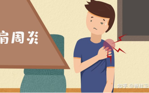 年龄大了得了肩周炎，做哪些运动能改善？（老年肩周炎怎么锻炼好）