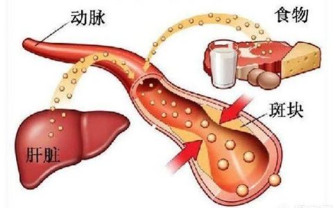 吃啥甘油三酯降得快？它的克星是什么？来看看医生给出的这些建议-吃什么甘油三酯高怎么降下来