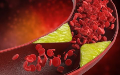 血脂高的人哪些食物不能吃？饮食如何降血脂？-血脂高有些什么食物不能吃