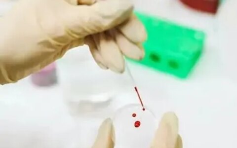 这些 “ 高脂 ”食物正在悄悄升高血脂，比吃肉还可怕！-高脂的食物是什么