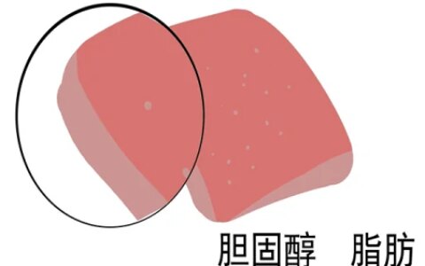 胆固醇高就不能吃鸡蛋和肉类？关于胆固醇，不少人有认知误区（胆固醇高不能吃鸡蛋对吗）