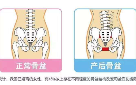 女性朋友生完宝宝后，到底要不要做产后修复-女性朋友生孩子