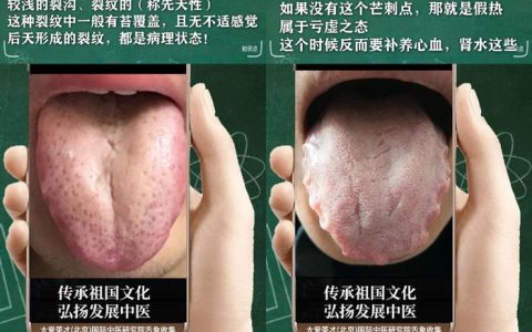 舌诊分析：生气、睡眠紊乱、水湿上泛、忽好忽坏很受影响-生气用中医学怎么说
