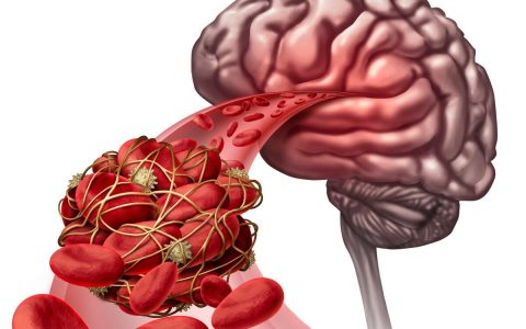 不吃药，如何才能降血压？请记住这6点-血压高不吃药怎么才能降下去