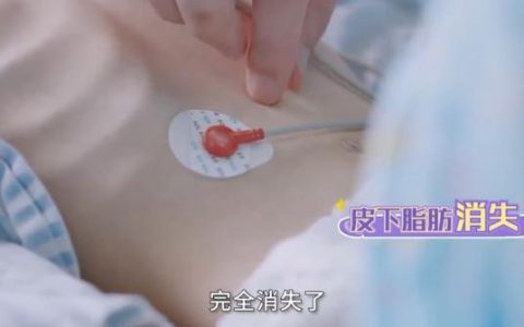 15岁少女减肥至24.8公斤去世，什么加剧了身材焦虑-东莞15岁女孩减肥