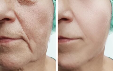 出现皱纹怎么办？推荐十大效果显著的除皱护肤品（去除皱纹的产品推荐）