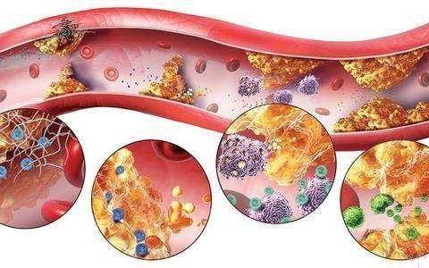 甘油三酯高吃什么才能降脂？生活化降脂很简单，六类食物要吃对！-甘油三酯高吃什么食物降得最快