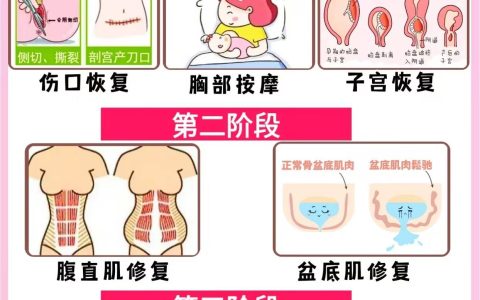 产后修复别乱做！盆底肌腹直肌修复方法-产后盆底肌腹直肌修复有必要吗