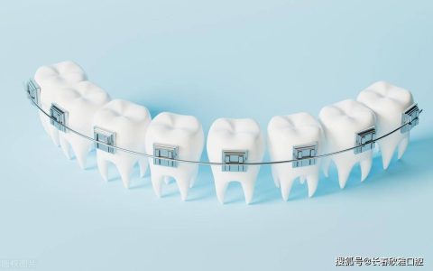 整牙一般花多少钱-县里整牙多少钱