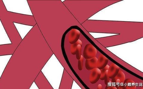 原创
甘油三酯高到5.6，算很严重了吗？要怎么才能降回到正常指标？