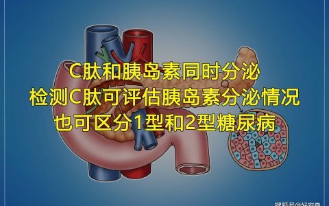 好安森糖尿病治疗仪：什么是C肽？检测C肽的作用是什么？(糖尿病治疗仪)