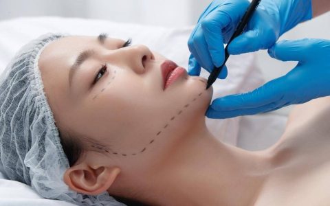 筋膜悬吊面部提升术保持多久、过来人讲述讲筋膜悬吊能维持多久~-面部筋膜悬吊术手术过程是怎样做的