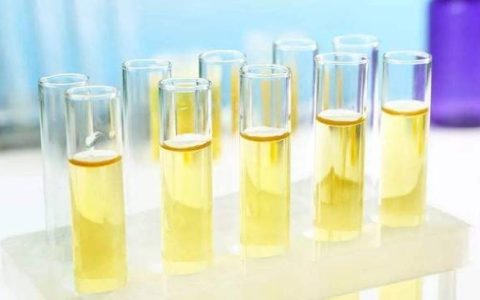 家佳诊： 尿液干化学检查原来有这么多的影响因素