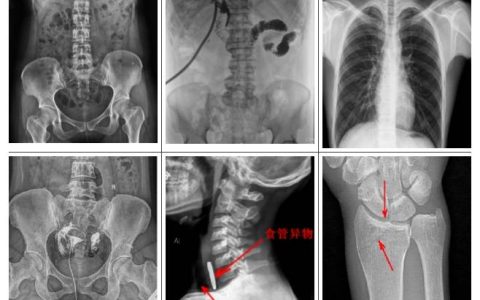 悬吊动态DR是什么意思？悬吊动态DR用途及临床优势介绍(悬吊dr是什么意思)