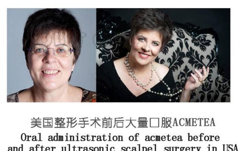 实锤了：筋膜悬吊面部提升术多少钱、筋膜提升多少钱~-筋膜悬吊多久有效果