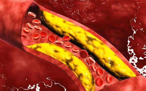 原创
发现甘油三酯高，怎样才能降下来？支招：这3个方法，比较靠谱