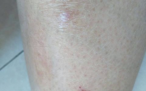 食疗真的有用吗？