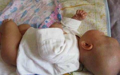 蚊香液引发中毒，一位宝宝险些丧命，24瓶小苏打救活他，要重视-蚊香液被孩子吃了孩子总擦嘴怎么回事