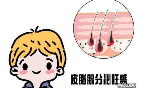 严重的痘痘怎么办 痘痘越来越严重-很严重的痘痘能好吗图片