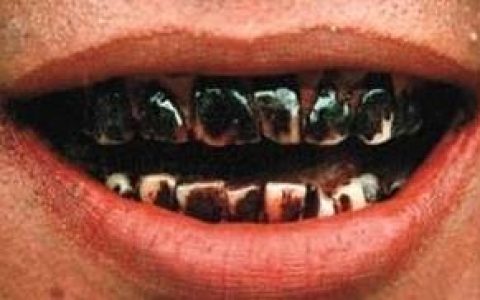 吃“槟榔”对身体有什么好处又有什么坏处呢？