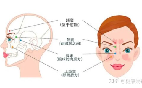 鼻窦炎的治疗方法有哪些（鼻窦炎治症状）