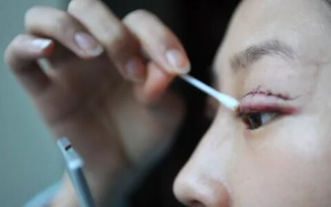 “3大常见五官缺陷与医美解决方案—怎样轻松拥有完美五官？”（五官有缺陷是什么意思）