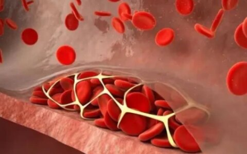 多散步对血管好？医生建议：50岁之后，坚持做这2件事或比运动好（散步对血压有好处吗）