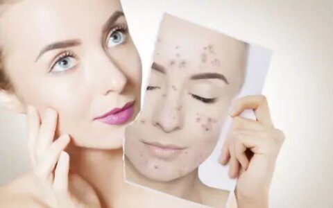 脸上长斑怎么办？推荐白术祛斑美容法（白术可以祛斑吗怎么用法）