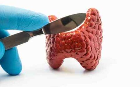 甲状腺有结节，白开水里加“一物”，抑制结节病变-甲状腺结节用什么泡水喝可以散结