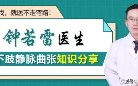 怎样治疗静脉曲张好得快？（怎样治疗静脉曲张好得快的方法图片）