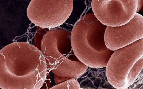 北京华科中西医结合医院血液科：发现血小板低吃什么补得快?（血小板低吃什么食物补得快百度知道）