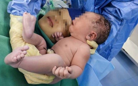 武汉夫妻诞下“镜面宝宝”,什么是“镜面宝宝”？-镜面宝宝有后遗症吗