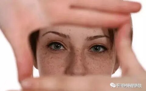 可见一“斑”，色斑及色沉的预防及治疗！-可见一斑为什么是斑点的斑?