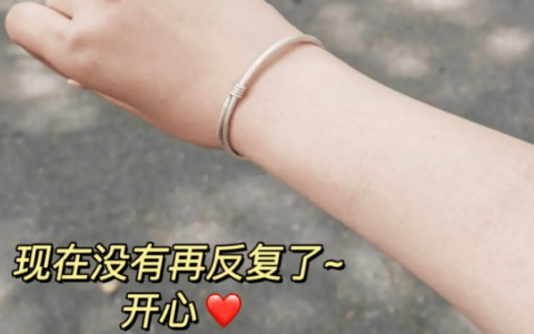 最快解决荨麻疹，能帮一个是一个！-轻松教你解决荨麻疹的方法