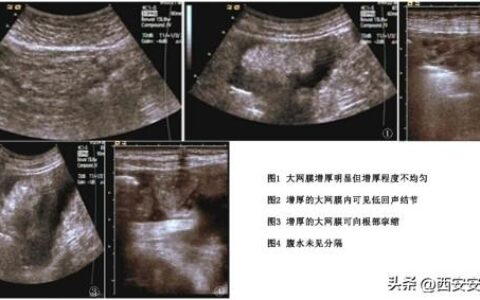 超声医疗高压功率放大器ATA-4315技术参数